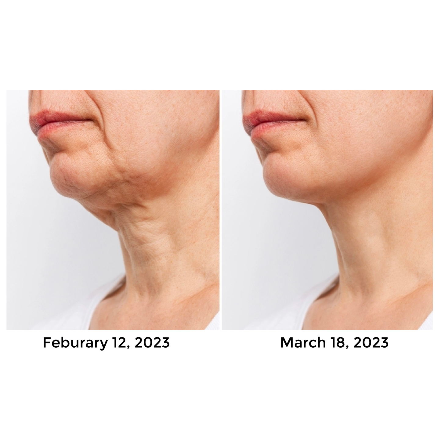 ATTDX AntiAging CollagenPeptide Serum