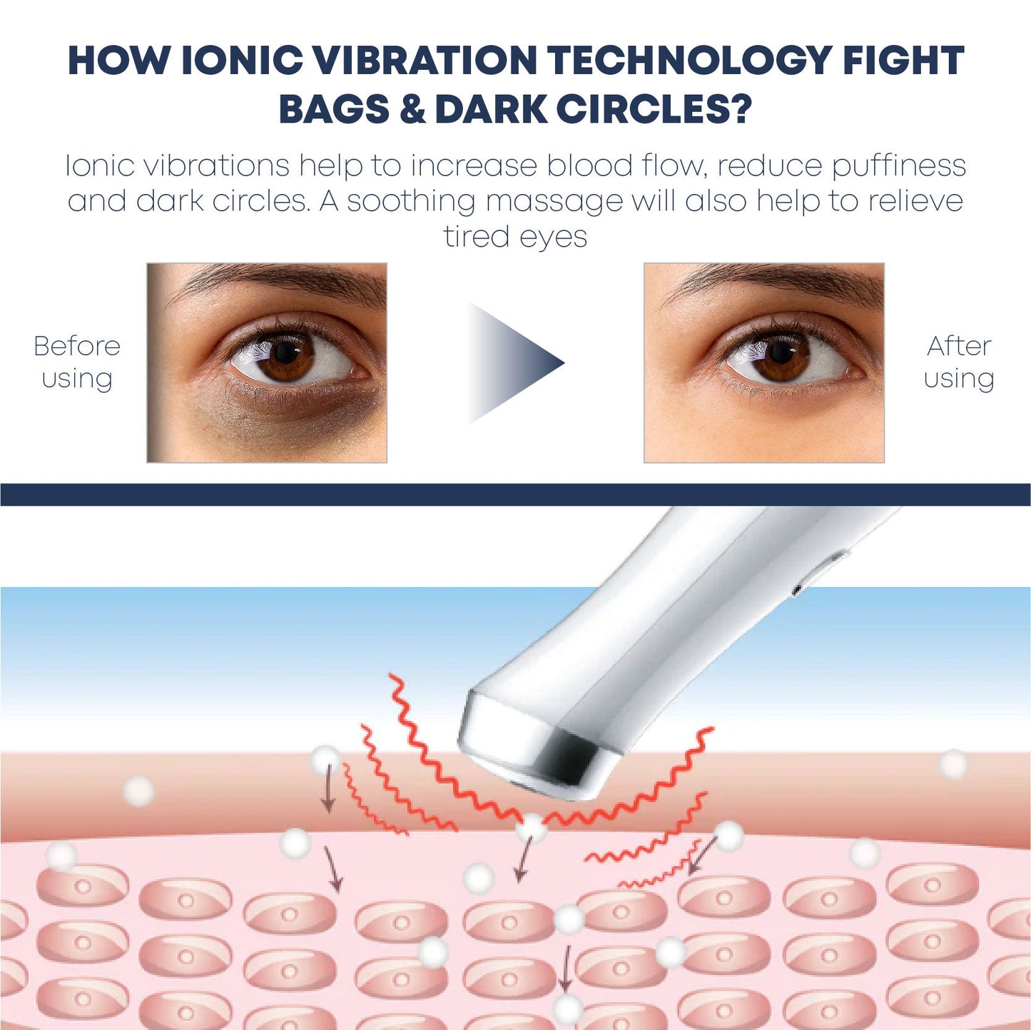 IONICMax CollagenVibration EyeMassage Pen