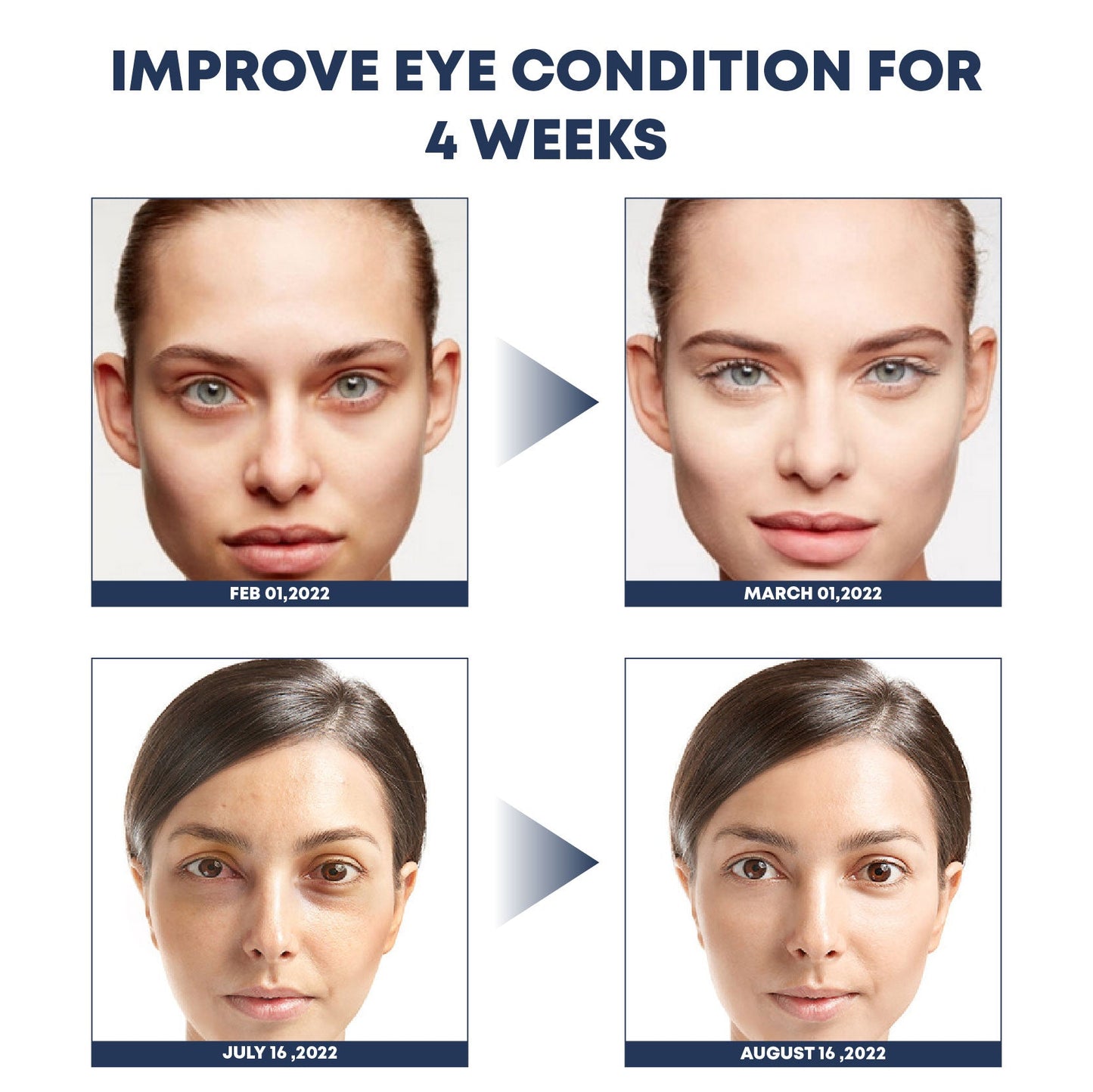 IONICMax CollagenVibration EyeMassage Pen