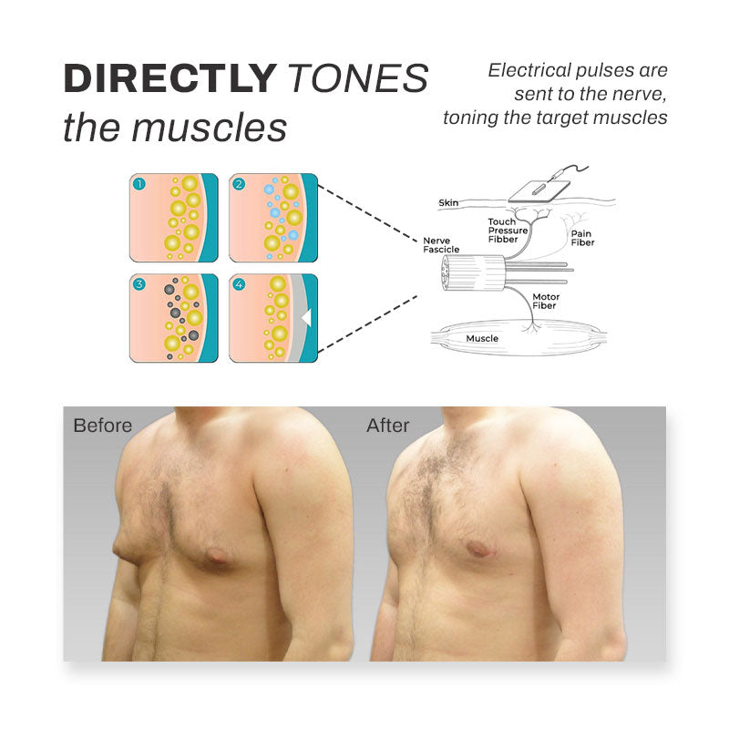 Microcurrent MenChest Gynecomastia Stimulator