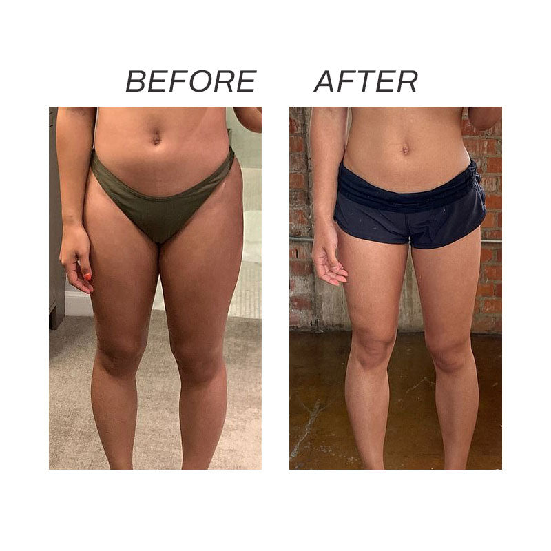 ProAcupoint SwellReduce LymphDetox ToeRing