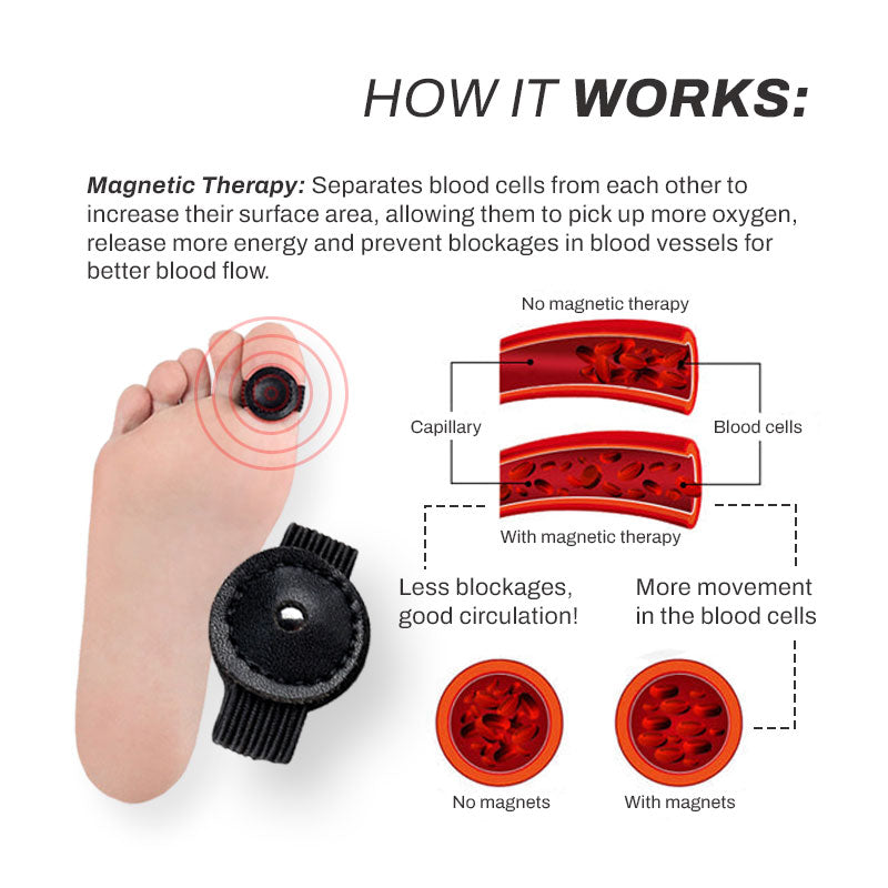 ProAcupoint SwellReduce LymphDetox ToeRing