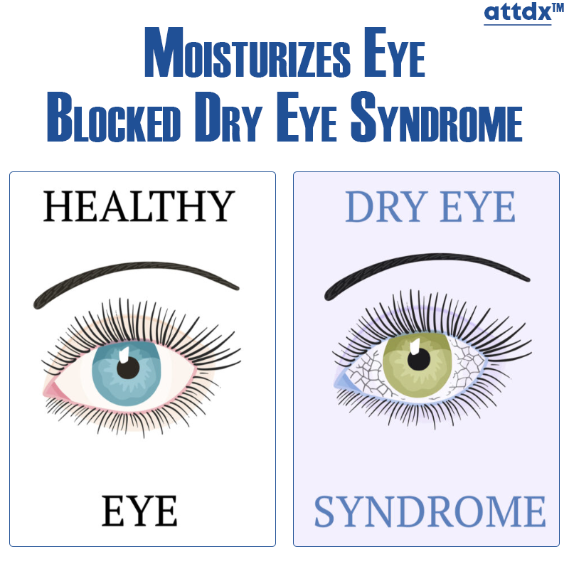 ATTDX Clear Sight Treatment Reversal Eye Drops