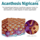 ATTDX ClearSkin Acanthosis Nigricans Therapy Cream