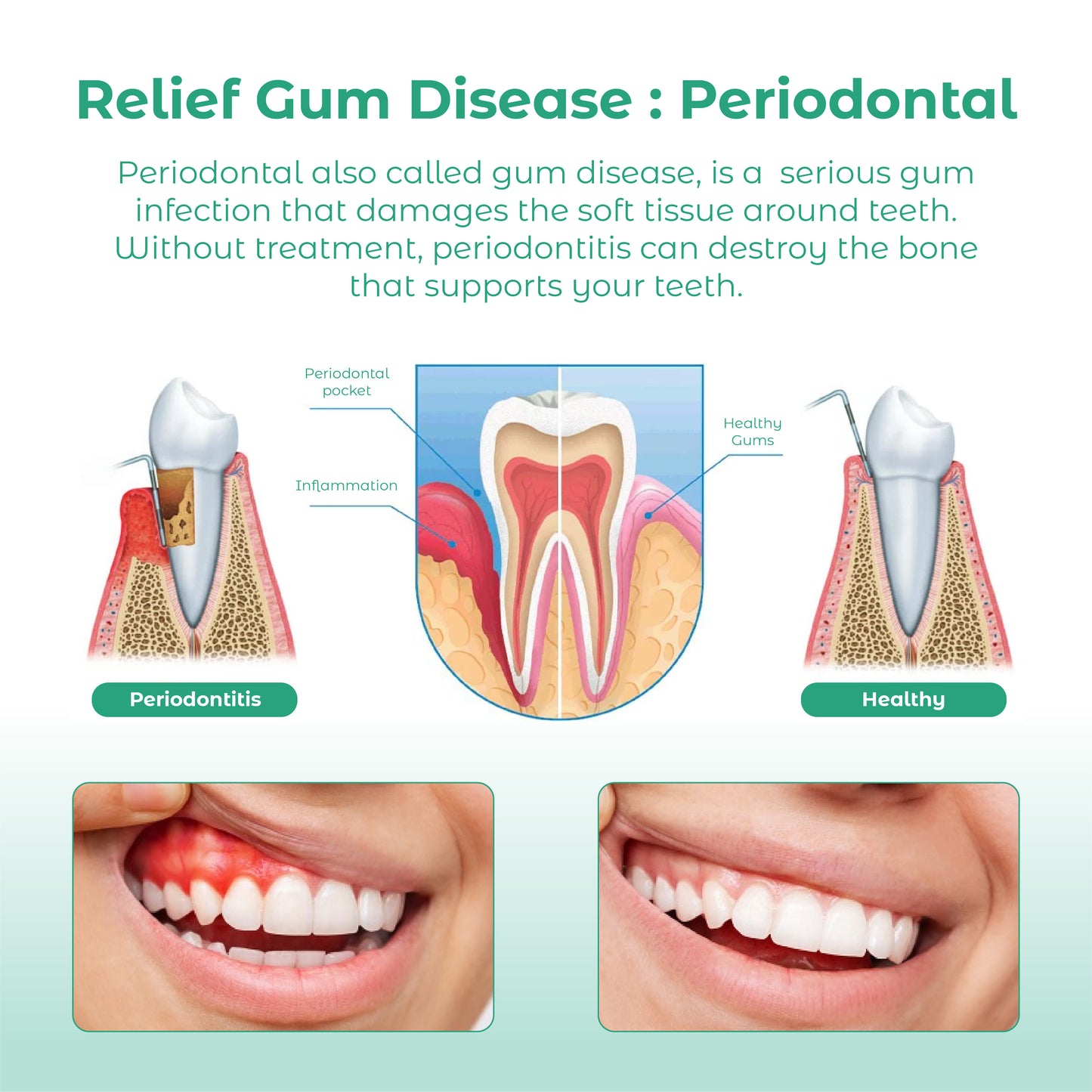 ATTDX Refresh whitening GumCare Pellets