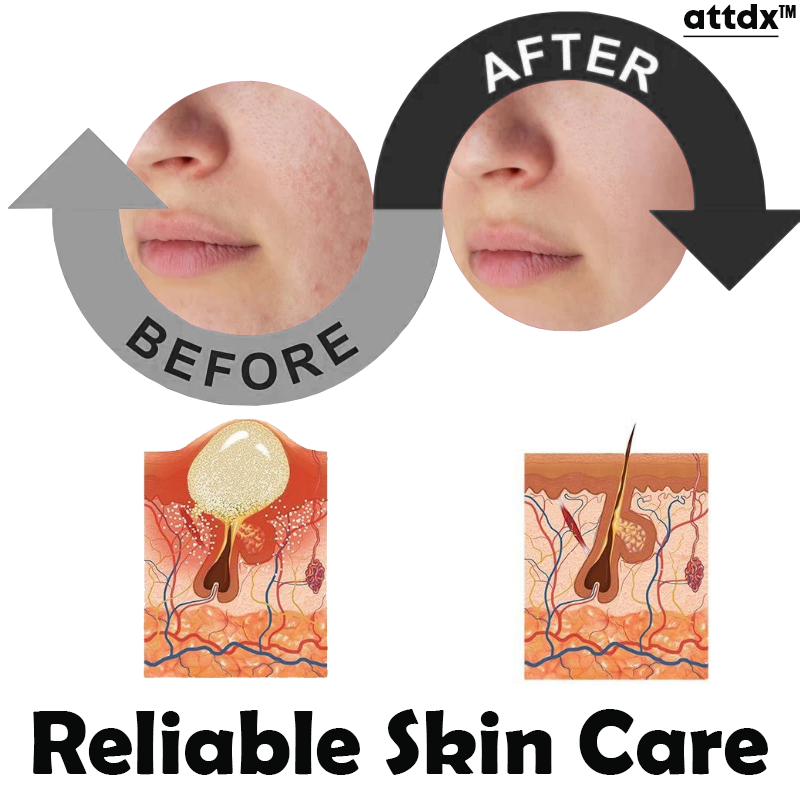 ATTDX SkinPurity Acne Youthful Serum