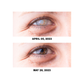 ATTDX Eye Problem Treatment Reversal Eye Drops