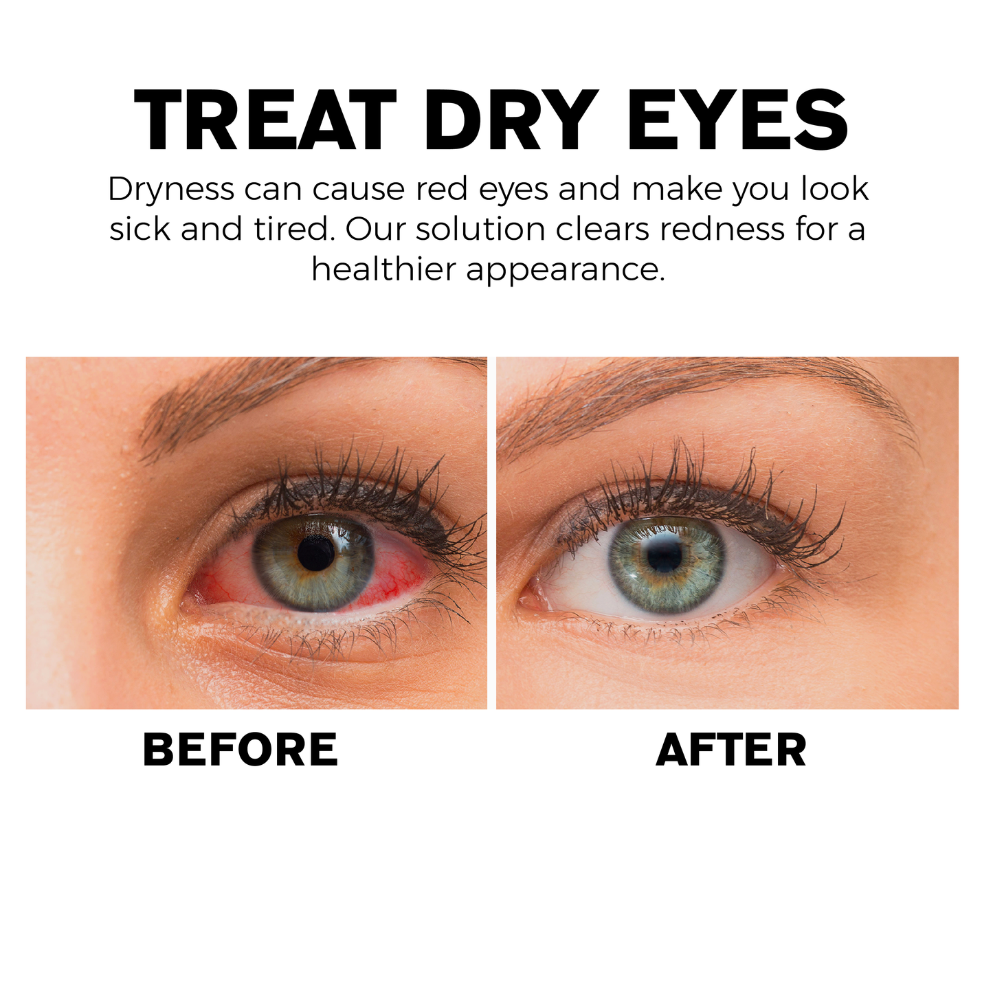 ATTDX Eye Problem Treatment Reversal Eye Drops