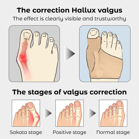 RICPIND 2 Hallux Harmony Correction Belt with Protective Sleeves