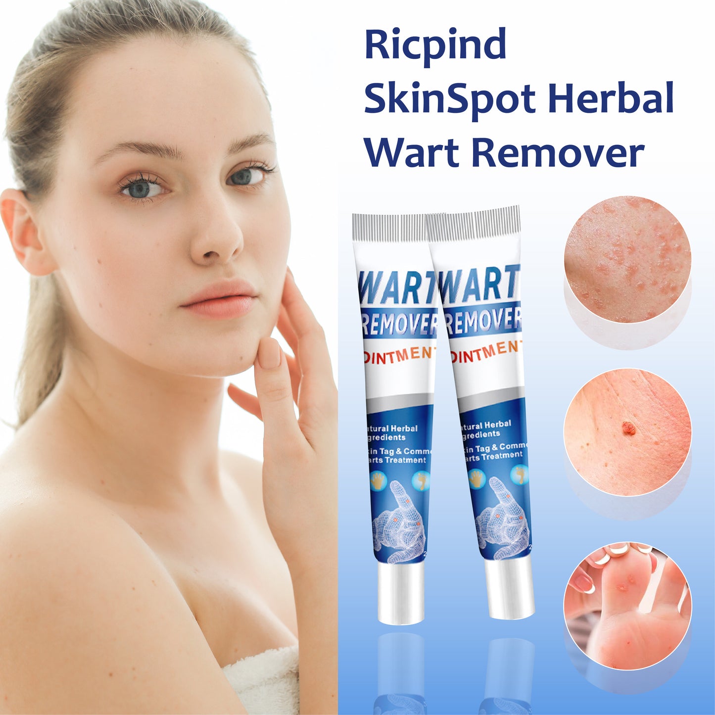 RICPIND SkinSpot Herbal Wart Remover