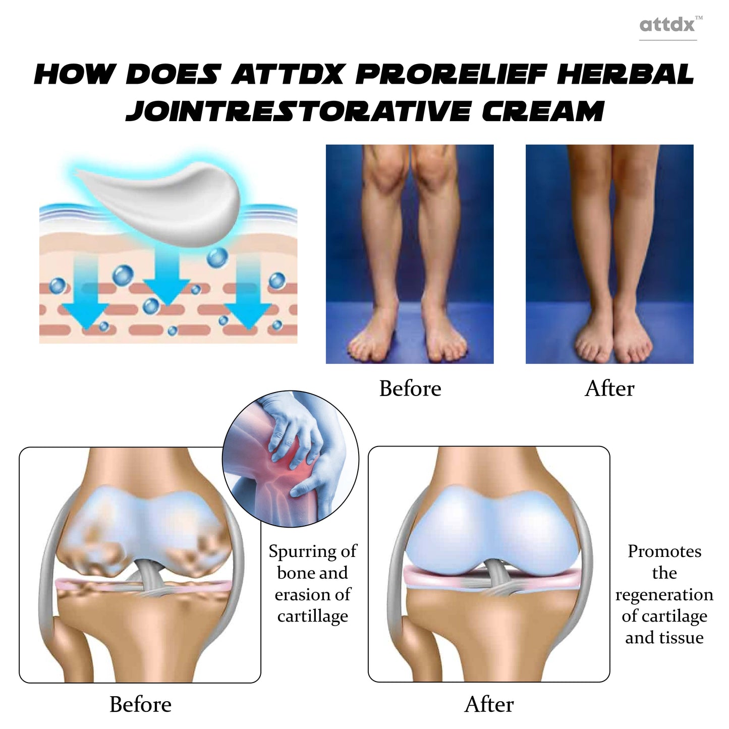 ATTDX ProRelief Herbal JointRestorative Cream