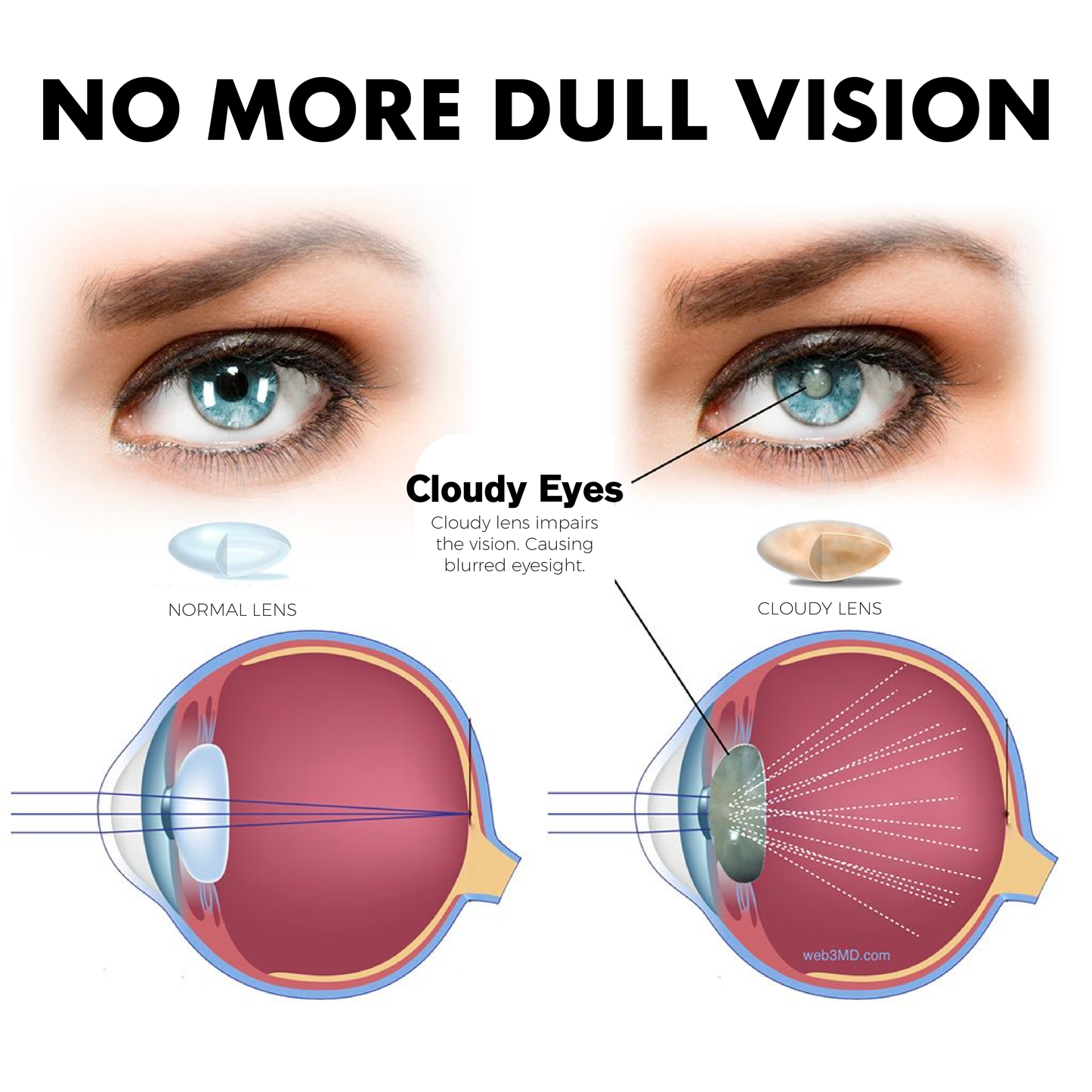 ATTDX Treatment EyeProblems SolutionDrops
