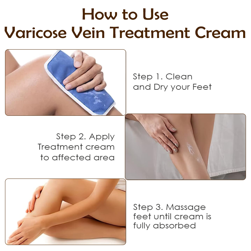 ATTDX Varicose Veins Treatment Cream