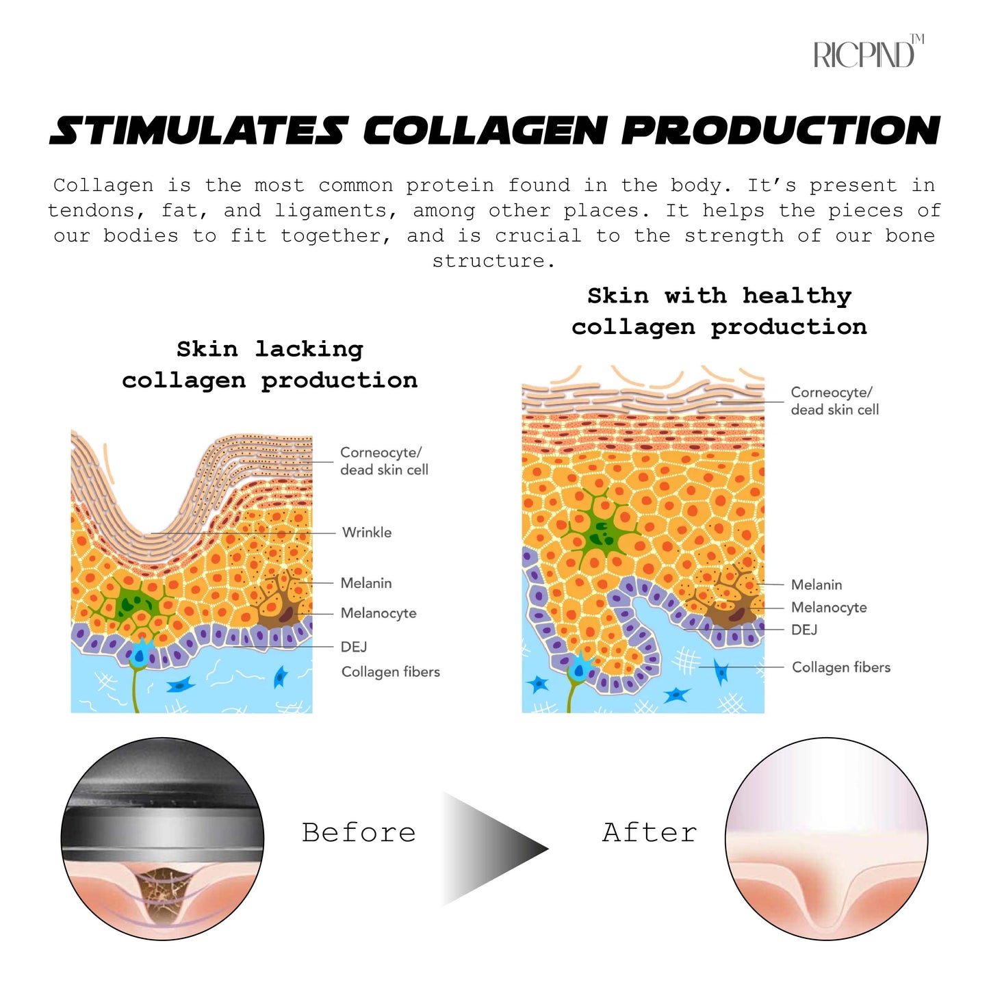 RICPIND Ultimate ColdLaser ThermaHeal ReliefDevice