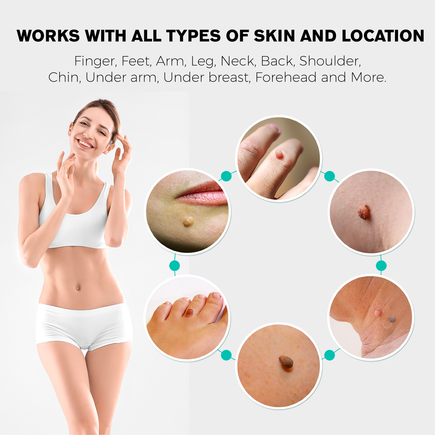 ATTDX AutoRemove SkinTag Kit