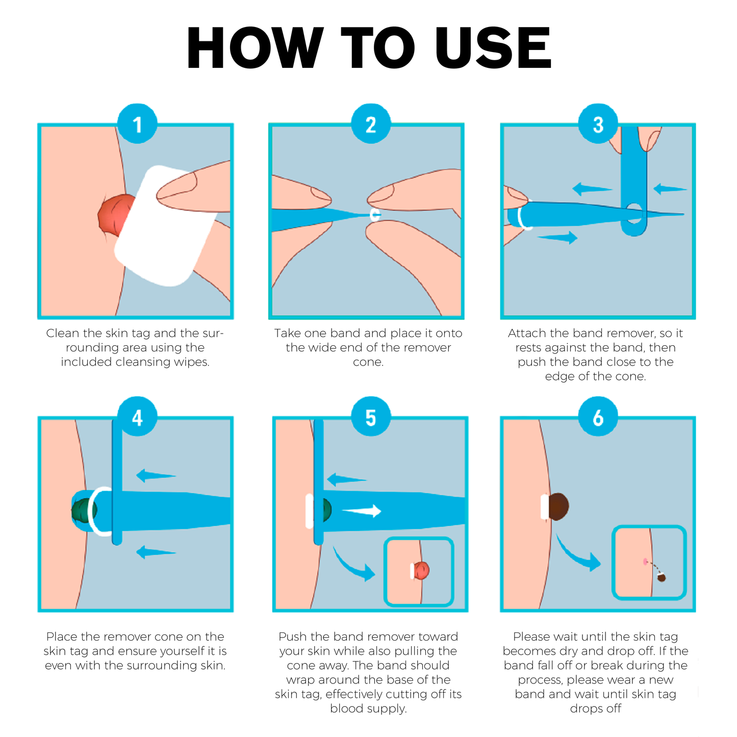 ATTDX AutoRemove SkinTag Kit