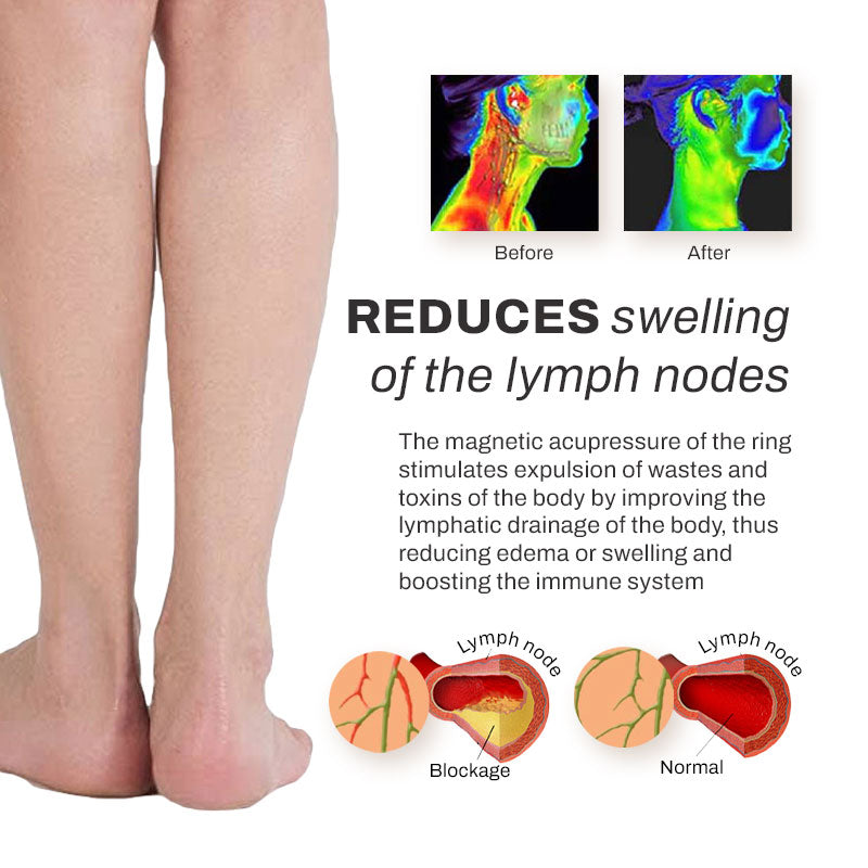 ProAcupoint SwellReduce LymphDetox ToeRing