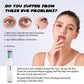 Ricpind EMS EyeWrinkle VFace Firming Instrument