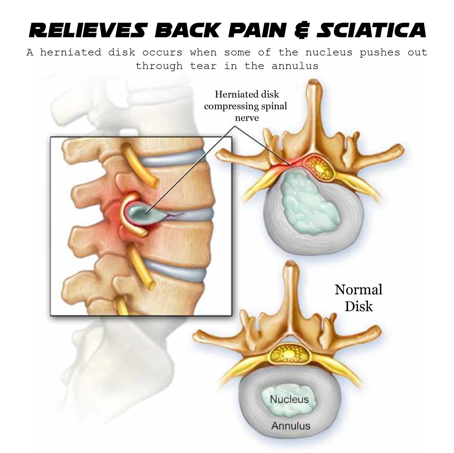 Ricpind EMS SciaticaReliever Therapeutic Massager