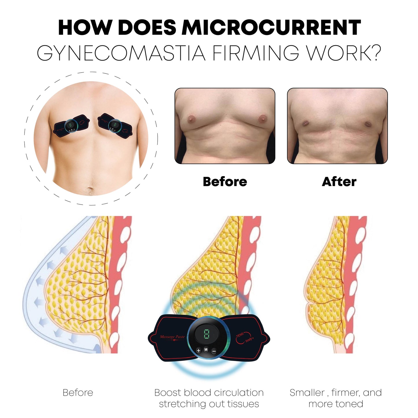 Ricpind Microcurrent Gynecomastia Reduction Massager