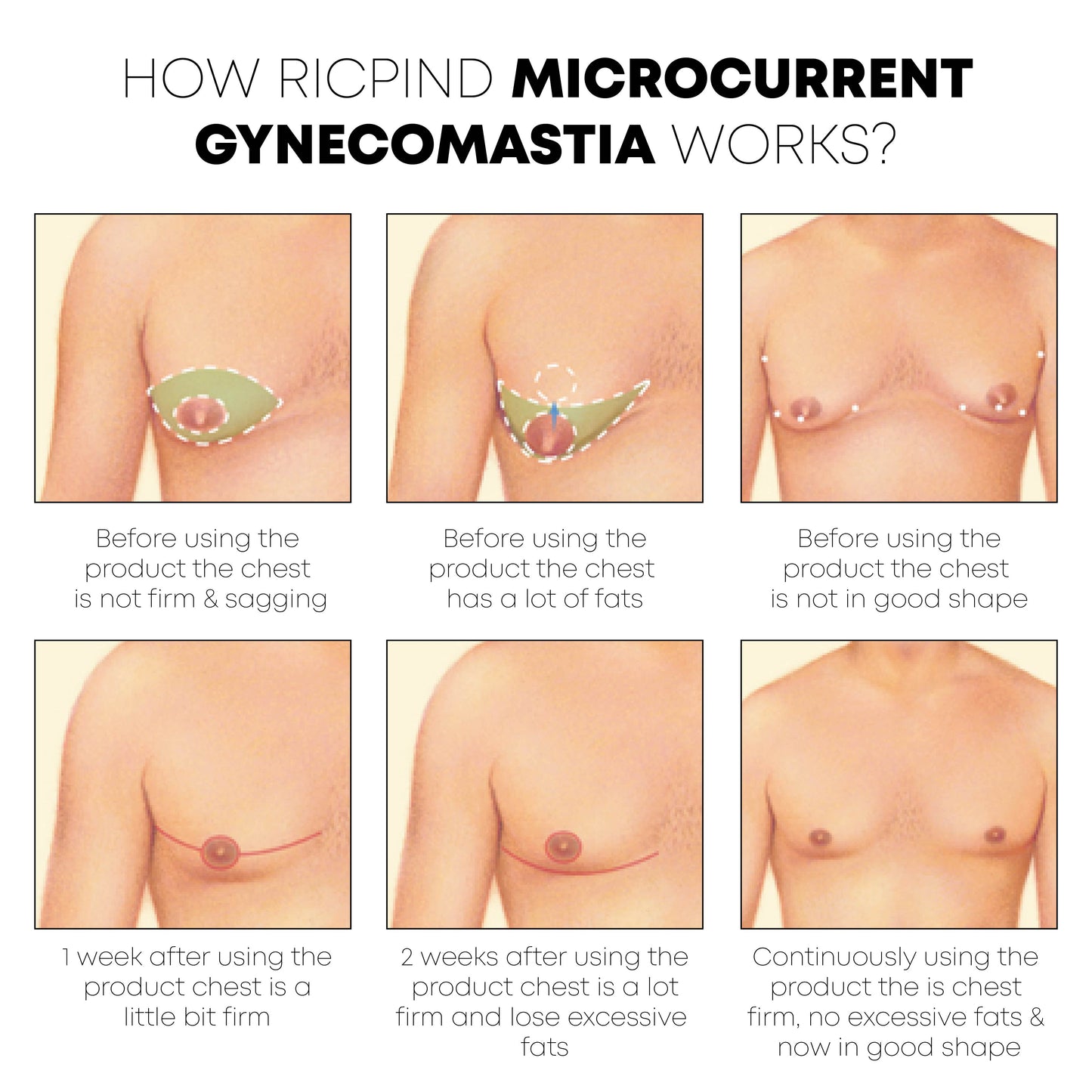 Ricpind Microcurrent Gynecomastia Reduction Massager
