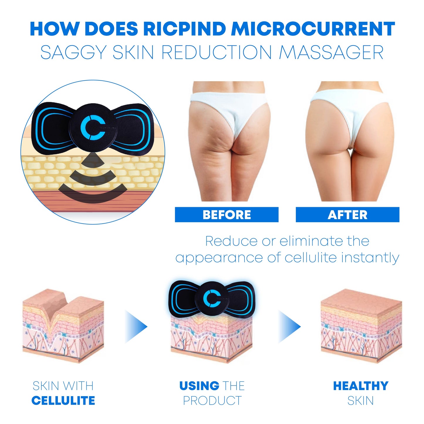 Ricpind Microcurrent SaggyReduction Massager