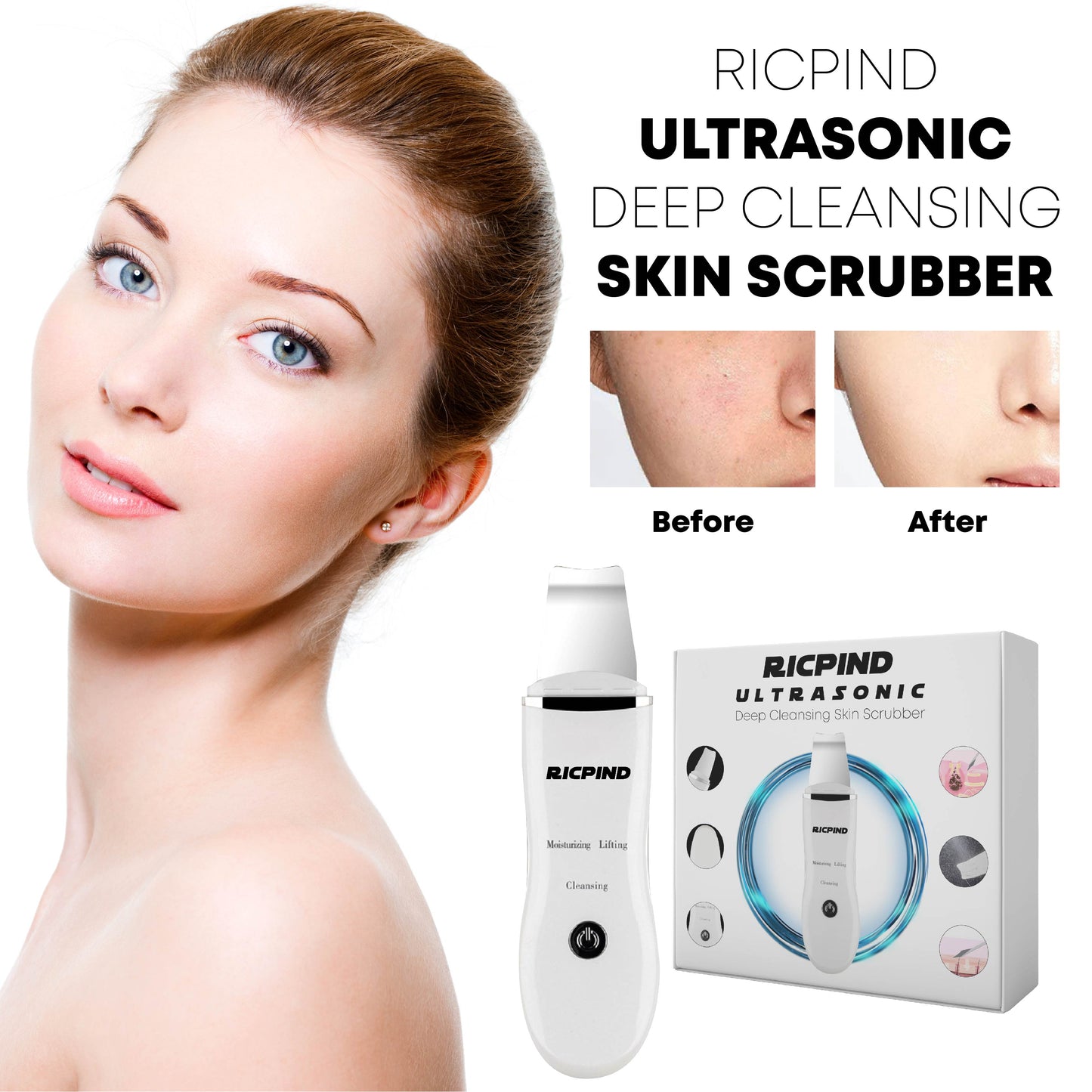 Ricpind Ultrasonic DeepCleansing Skin Scrubber